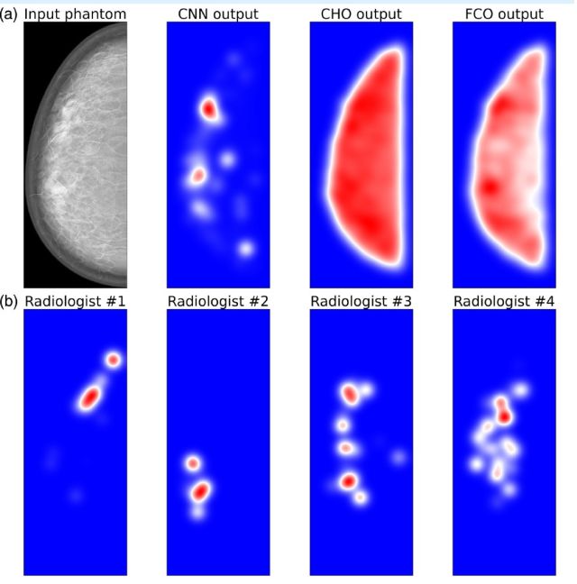 Top row: Suspicious locations in Digital Breast Tomosynthesis phantom for linear model observers and Convolutional Neural Network. Bottom row: Radiologists fixation density for the image.